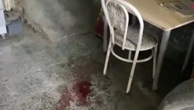 Sandalyeden Düşerek Hayatını Değiştiren Adamın Dramı