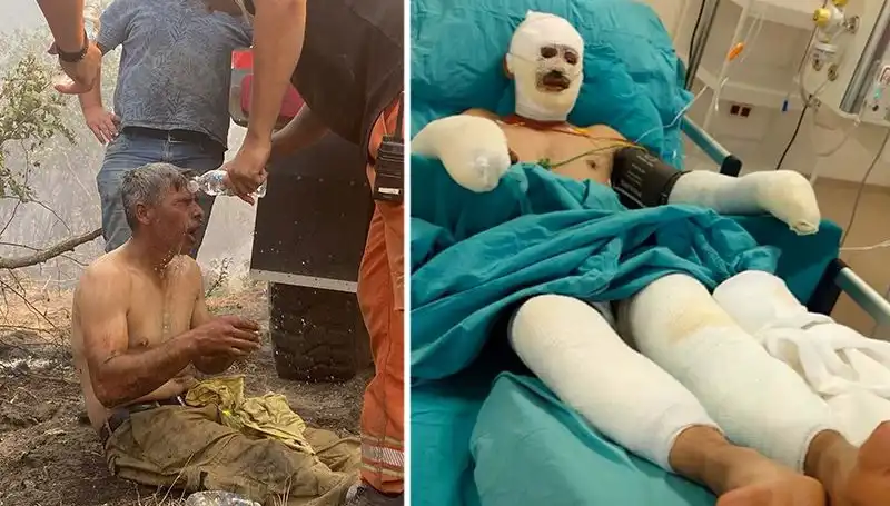 Orman İşçisinin "Yanıyorum" Feryadı, Kurtarma Operasyonuyla Hayata Tutundu