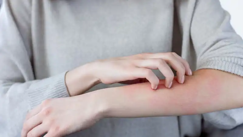 Cilt Kanserinin Gizli Belirtileri: Dermatologdan İki Kritik İpucu