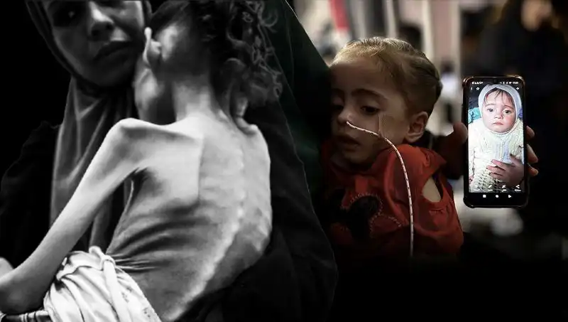 Küçük Meryem'in Açlıkla Mücadele Hikayesi: 25 Kilodan 10 Kiloya Düştü