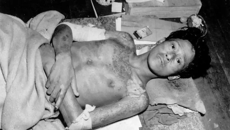 80 Yıl Sonra Nagasaki’den Gelen Acil Uyarı: Nükleer Tehdit Yeniden Gündemde!