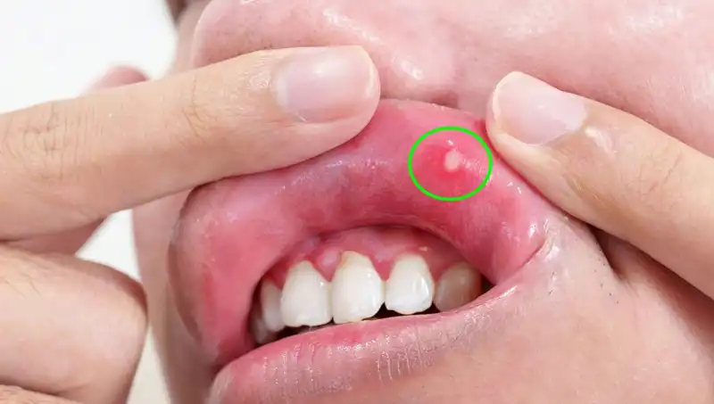 Vücudunuzda B Vitamini Eksik Mi? Belirtilerini Keşfedin!